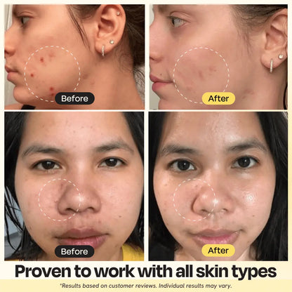 Vitamin C Clay Mask Gleamin